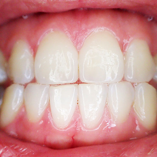 Closeup of healthy teeth