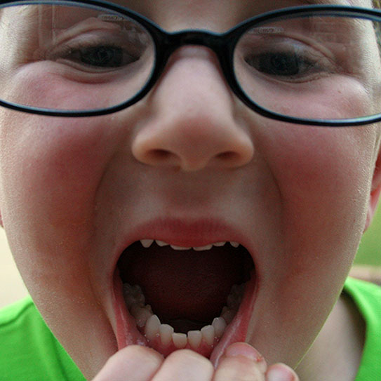 little boy pulling lip to show teeth