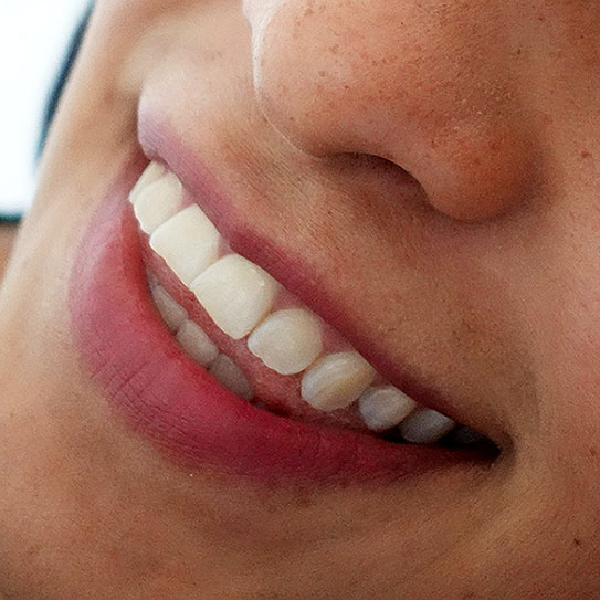 close up of pearly white teeth