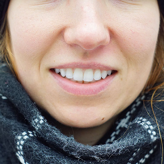 close up of a womans teeth