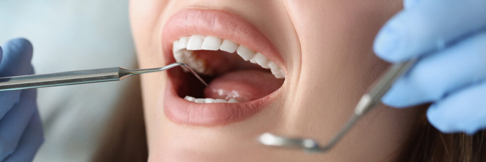 Dentist examines oral cavity of woman patient. Dental hygiene and regular dental visits