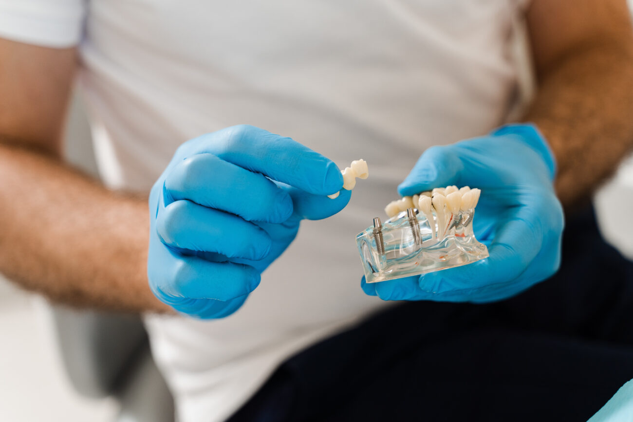 Dental implant model showing a plastic jaw with implant prosthetics