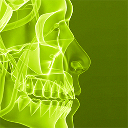 teeth and sinuses diagram